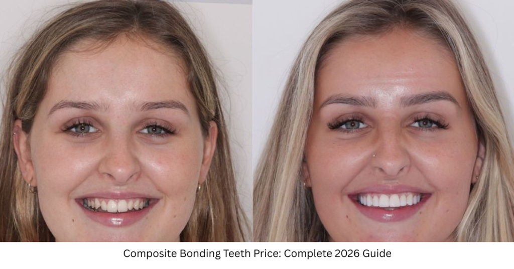 Composite Bonding Teeth Price: Complete 2026 Guide
