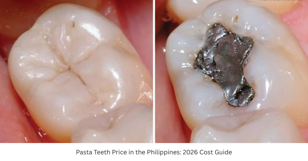 Pasta Teeth Price in the Philippines: 2026 Cost Guide