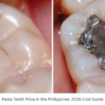 Pasta Teeth Price in the Philippines: 2026 Cost Guide